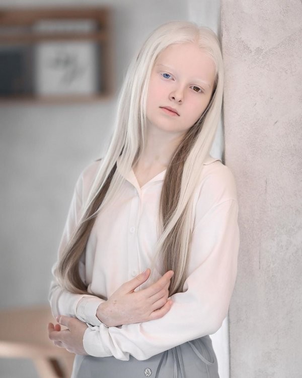 Амина Эпендиева - 11 летняя девочка из Чечни (7 фото)