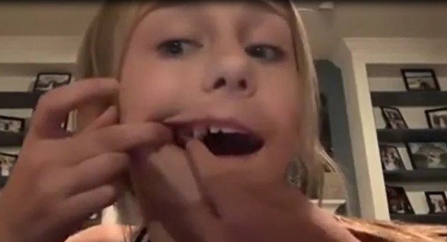 Кто поможет ребенку удалить зуб