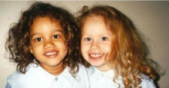 Как выглядят сегодня cестры-близнецы с разным цветом кожи, которые стали совсем взрослыми