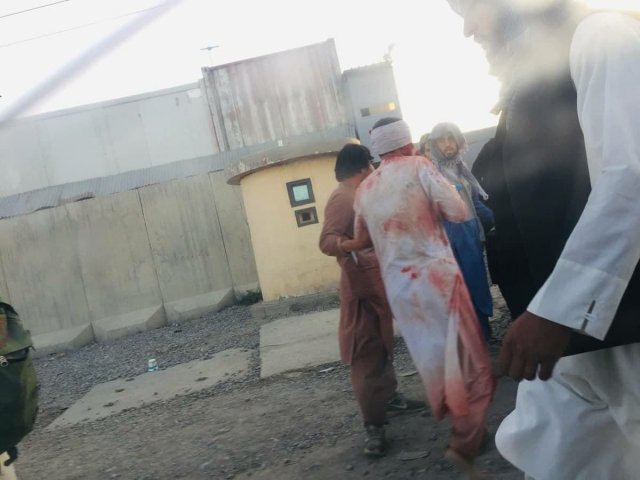 Теракты в Кабуле: взрыв у отеля, второй в аэропорту, десятки раненых и погибшие