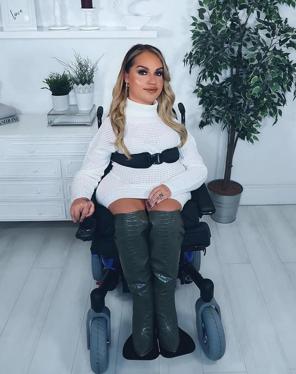 Самые настоящие герои: девушки-инвалиды, которые прославились в Instagram